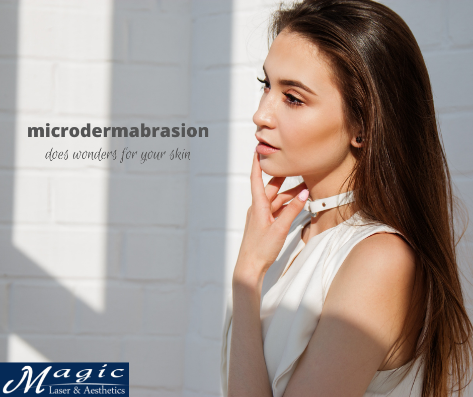 microdermabrasion toronto