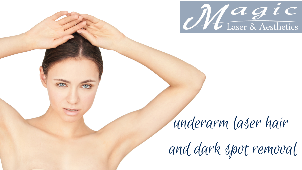 underarm laser hair and dark spot removal lightening